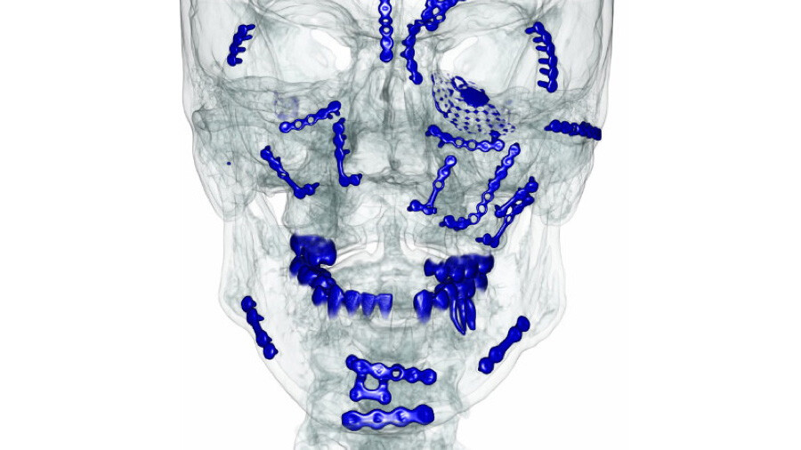 Dr Joel Tuckett Facial trauma surgery Brisbane